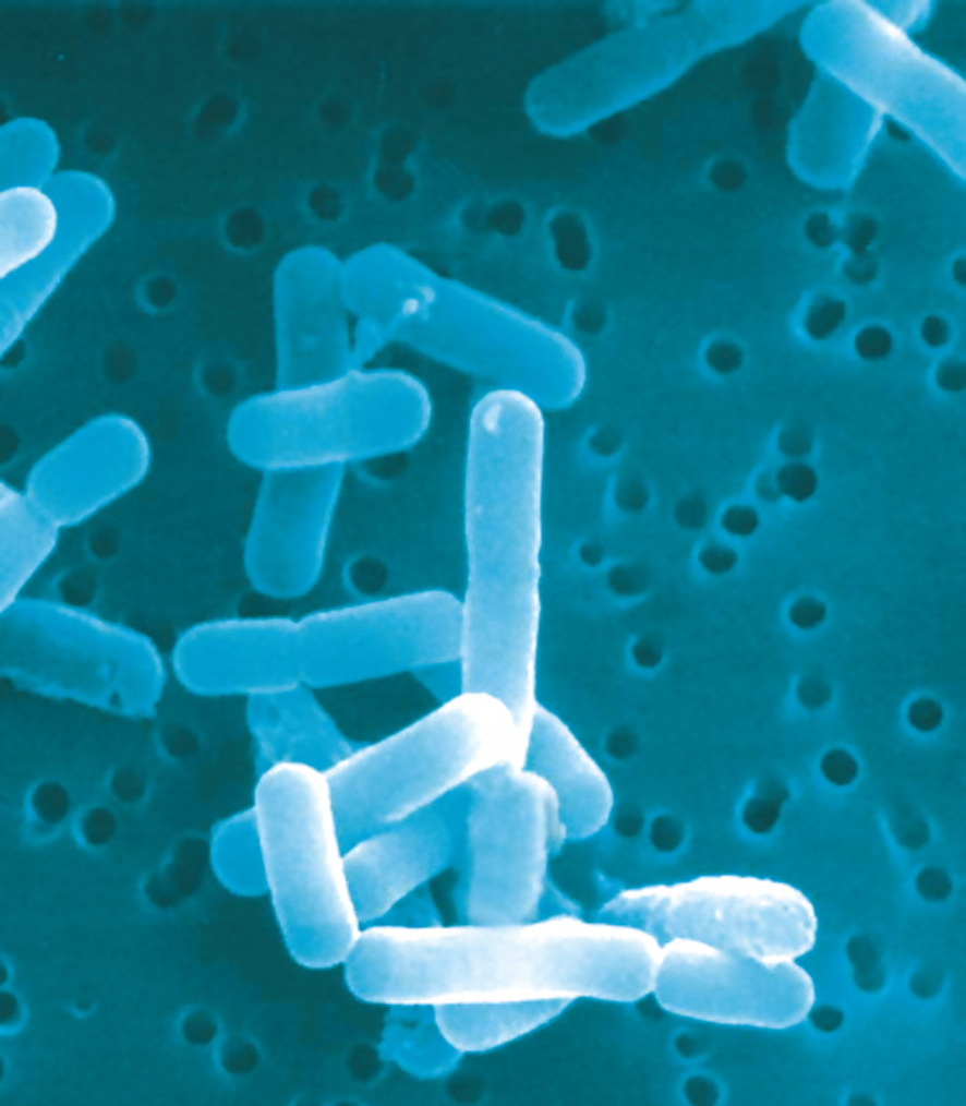 Lactobacillus reuteri Prodentis.