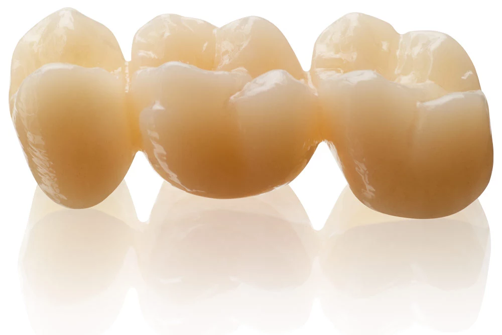 Ab sofort bei BEGO in 13 Farben erhältlich: hochästhetische Versorgungen aus KATANA Zirconia STML.