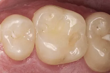 Klinische Aussgangssituation ...