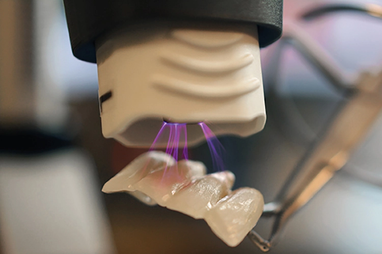 piezobrush® PZ3 Plasma-Handgerät bei der Plasmaaktivierung von Prothetik.