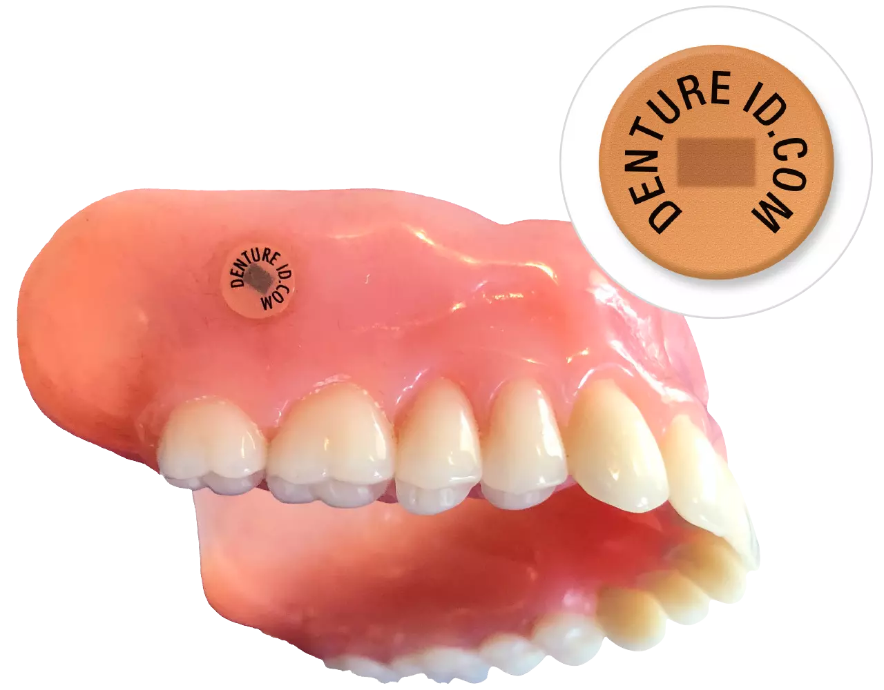 Prothese mit dem DentureID Chip.