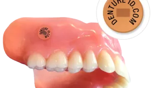 Prothese mit eingebettetem DentureID-Chip.