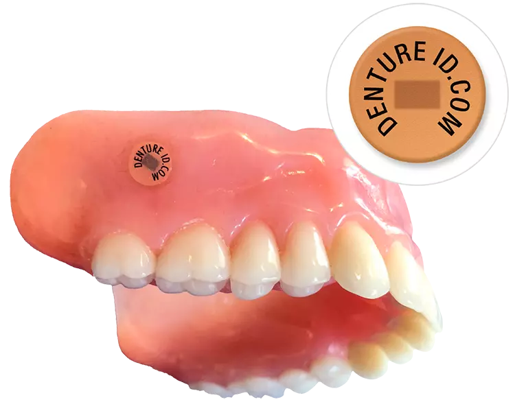 Prothese mit eingebettetem DentureID-Chip.