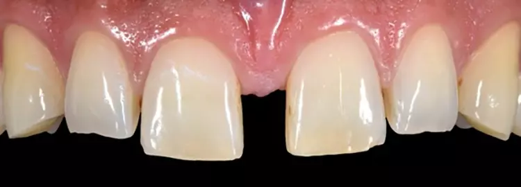 Abb. 26a: Ein Vorher-Nachher-Bild im Vergleich.