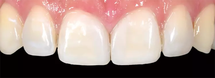 Abb. 26b: Ein Vorher-Nachher-Bild im Vergleich.