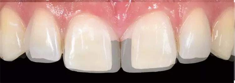 Abb. 26c: Ein Vorher-Nachher-Bild im Vergleich.