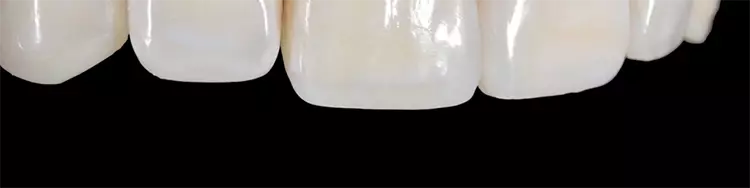 Abb. 27: Abschlussfoto nach Korrektur der farblich nicht passenden Areale. Die
Integration kann als gelungen bezeichnet werden.