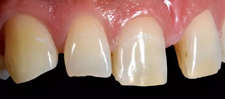 Abb. 2: Laterale Ansicht.