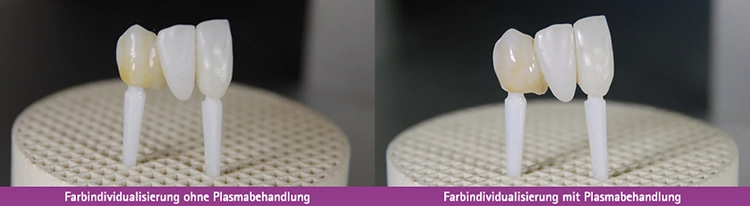 Farbindividualisierung mit und ohne Plasma