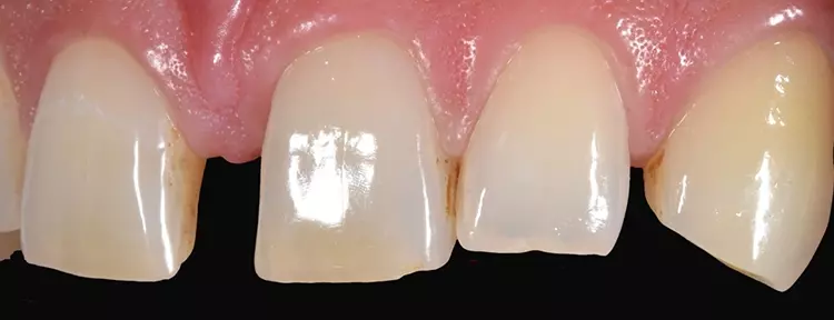 Abb. 3: Laterale Ansicht.