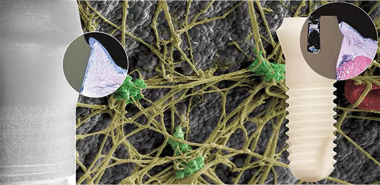 Abb. 1: Durch Blutgerinnung bildet sich innerhalb von Minuten nach der Insertion ein Fibrinnetzwerk an der Oberfläche des Patent™ Implantats.