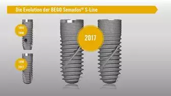 Die Evolution der BEGO Semados® S-Line.