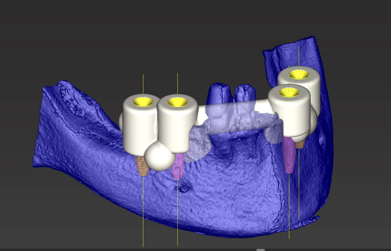 Abb. 10: 3D-Rekonstruktion.