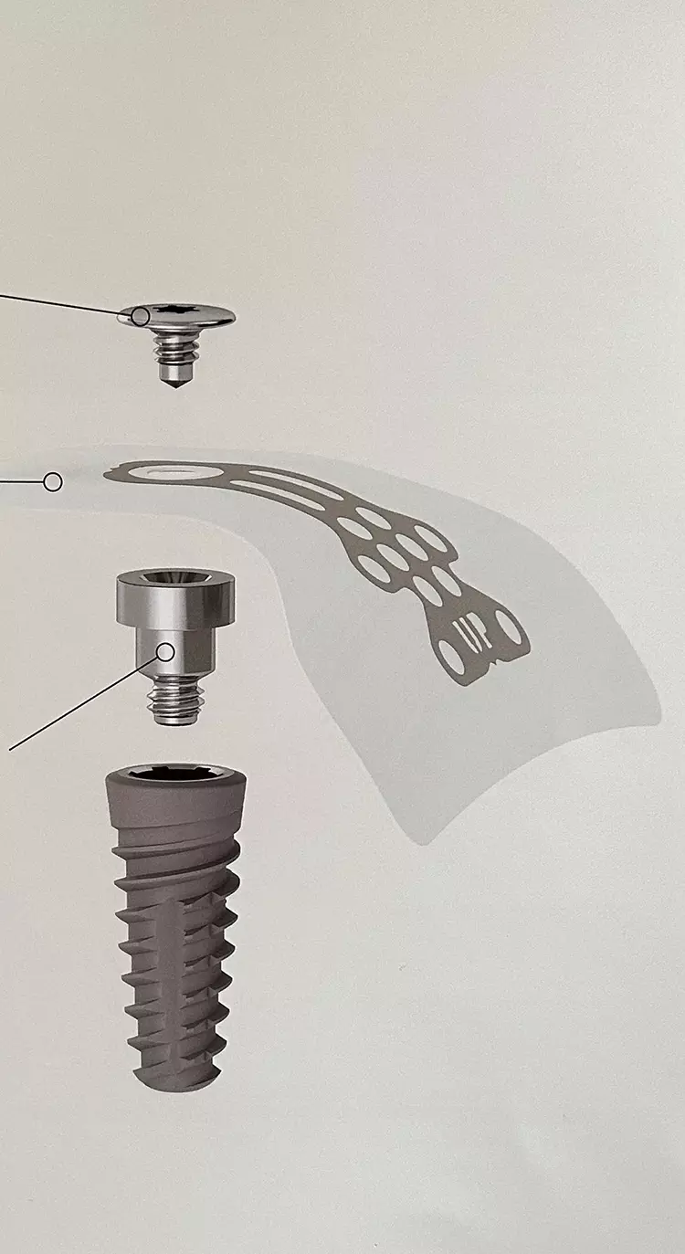 Abb. 14: Neue Wirkstoffkombination bei meridol®.