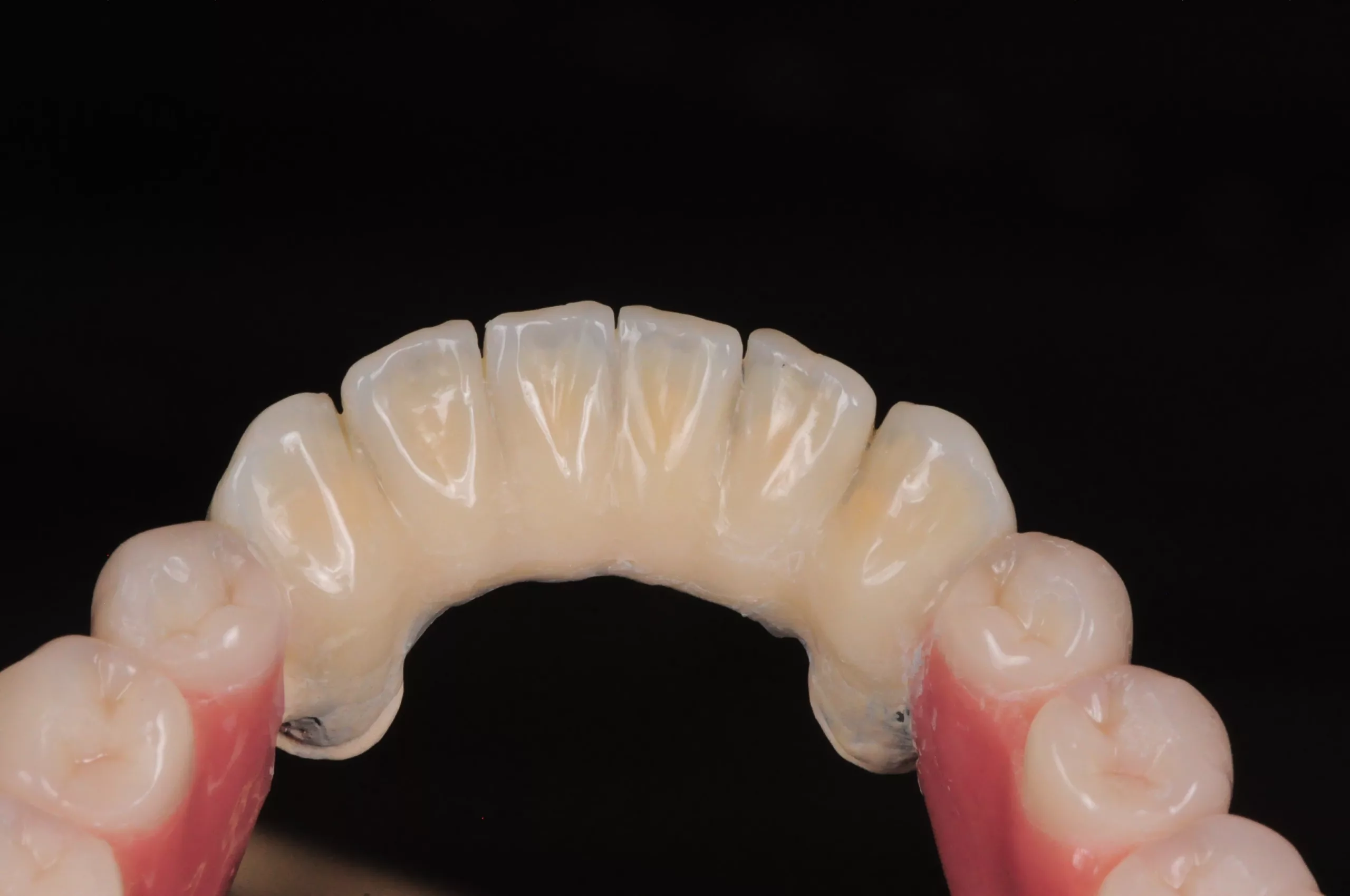 Abb. 11: ... von labial und lingual.