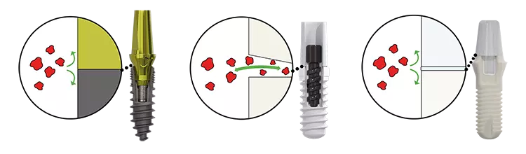 Abb. 16: Vergleich Revolutions-Implantat und Patent.