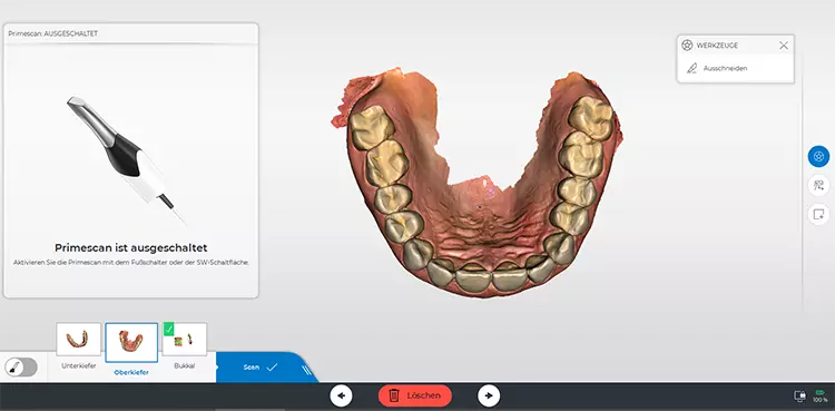 Abb. 2a: Vollständiger Scan des Oberkiefers (a) und Unterkiefers (b) mit der CEREC Primescan.