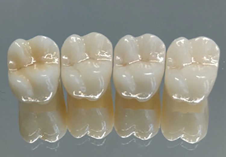Abb. 2a: Krone Aidite 3D-Multi A3, Prettau 2 Dispersive A3, Prettau 4 Dispersive A3 und eine handeingefärbte Krone in A3.