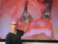 Prof. Markus Hürzeler zeigte anhand von Patientenfällen Vorgehensweisen, Limitationen, Alternativen, Lösungswege.