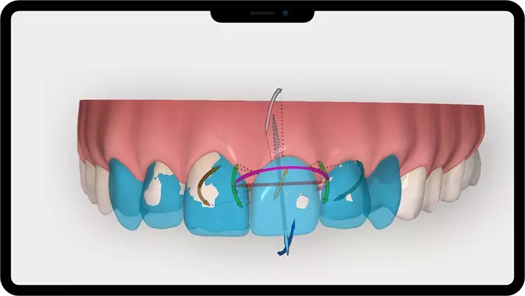 Abb. 3: Funktion 3D-Tools.