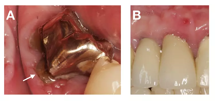 Klinische Beispiele für relevante dentale Befunde.