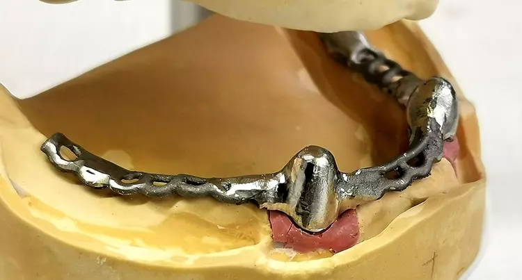 Abb. 5: Mit Friktion und schaukelfrei sitzt die Sekundärkonstruktion auf dem
Modell.