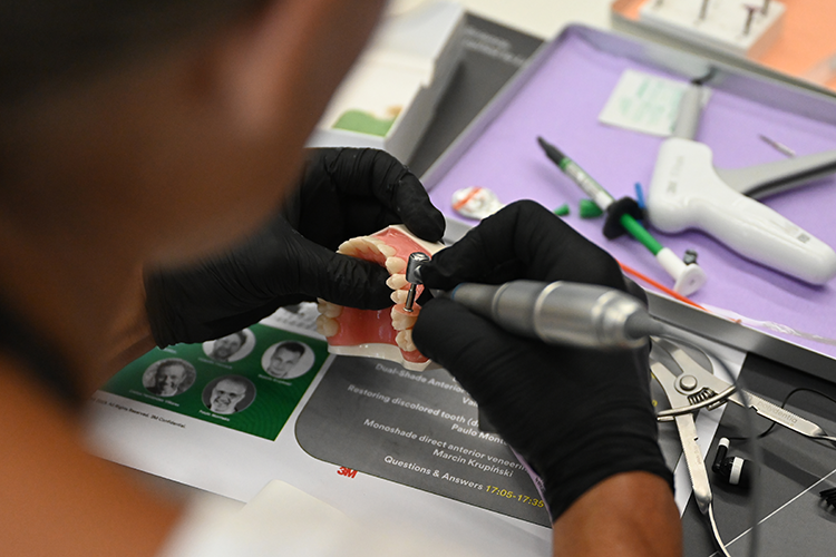 Ausarbeitung der Approximalfläche.