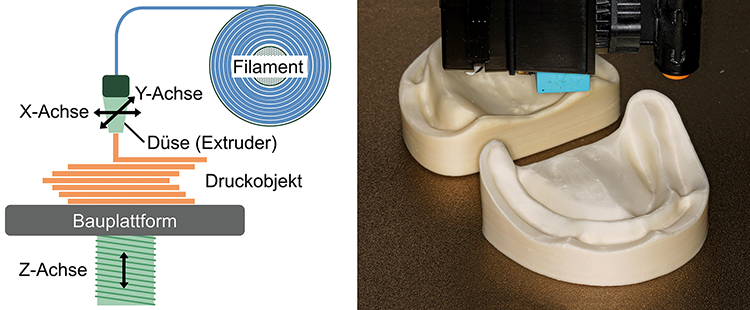Abb. 7: (a) Schematischer Aufbau eines FDM-Druckers: Das Filament auf einer Spule wird dem Extruder
zugeführt, dort geschmolzen und Schicht für Schicht in der X- und Y-Achse aufgetragen. Nach jeder Schicht
wird die Z-Achse abgesenkt, und der Vorgang beginnt von Neuem. (b) Situationsmodelle eines unbezahnten
Ober- und Unterkiefers nach dem Druckvorgang vor dem Ablösen von der Bauplattform.