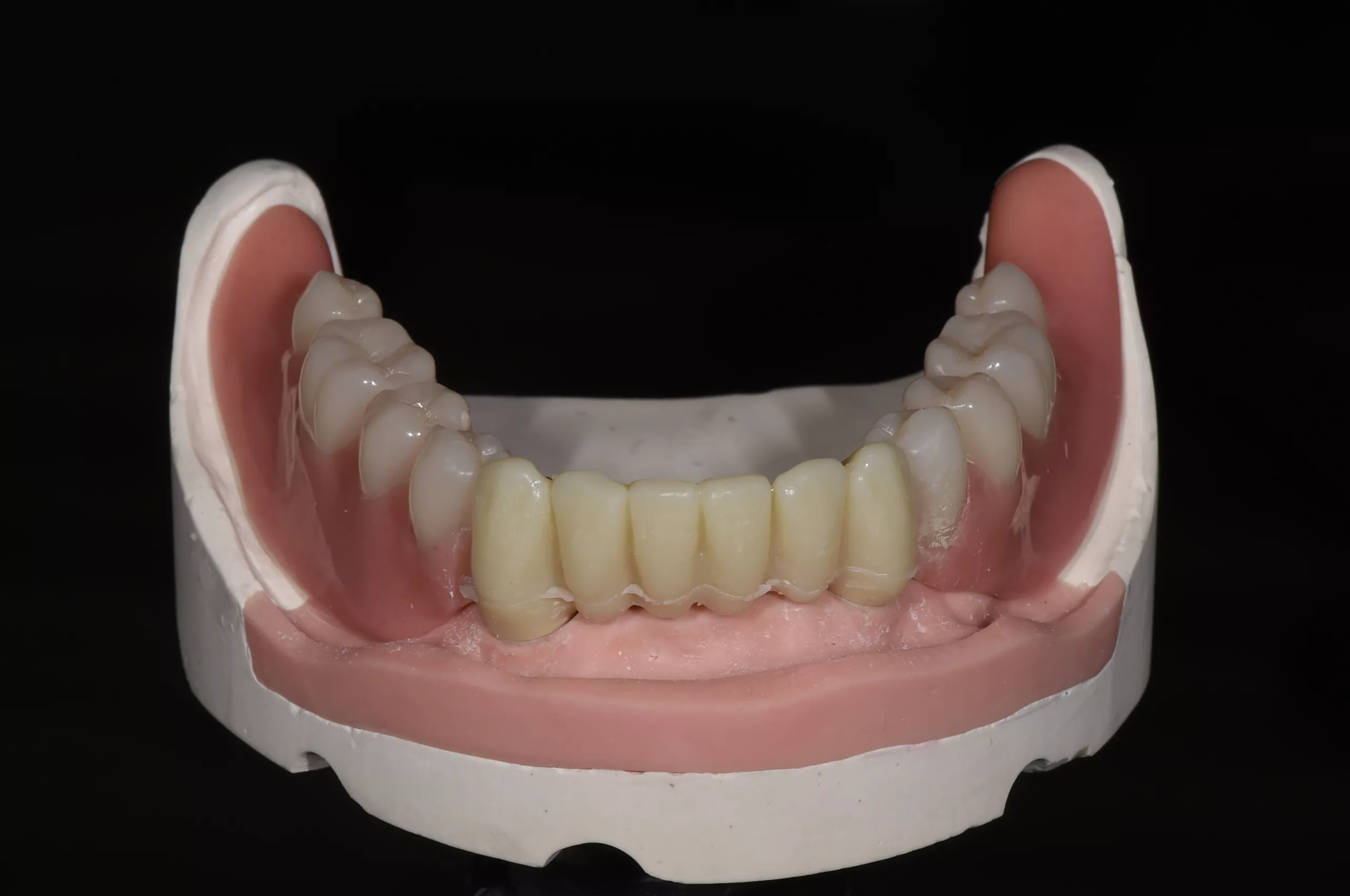 Abb. 8: Dentin-Pressung nach dem Ausbetten.