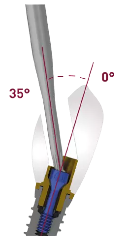 Dynamic Tibase® Ti-Legierung, anodisiert.