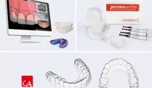 Dental Planning Center – DSD by PERMADENTAL, permaWhite und CA® Clear Aligner in der Übersicht.