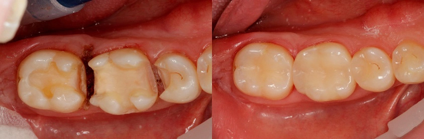 Die Ausgangs- und Endsituation.