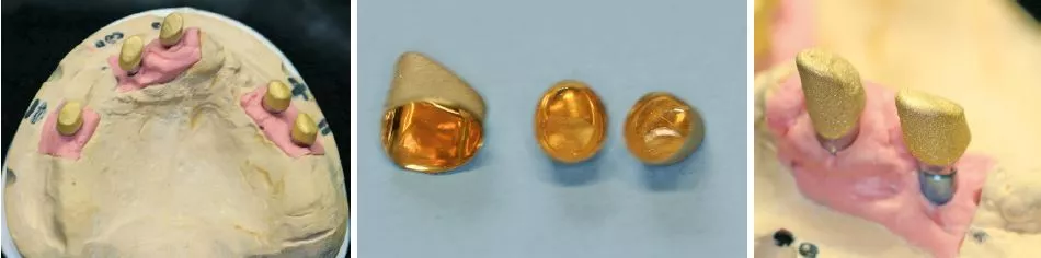 Abb. 11a–c: Die Galvano-Käppchen sind fertig.