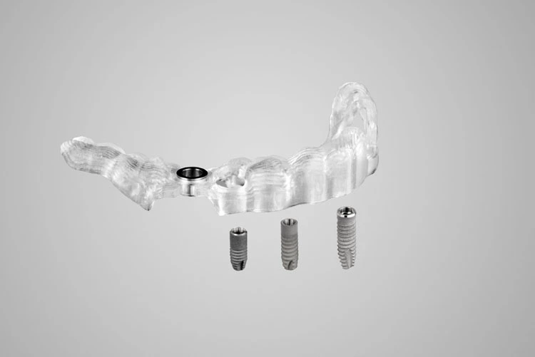 CEREC Guide 3 komplettiert den chairside Digital Implant Workflow und ermöglicht eine klinisch sichere Umsetzung der prothetisch orientierten Planung durch eine vollgeführte Insertion.