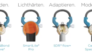 Ein umfassendes System für den Klasse-II-Erfolg: Class II Solution von Dentsply Sirona. 
© Dentsply Sirona
