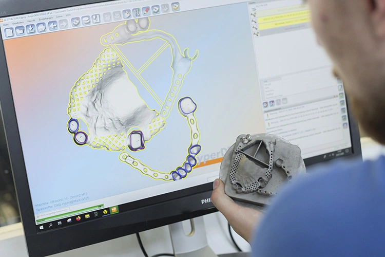 Um Dentallaboren kürzeste Lieferzeiten zu bieten, hat der Zerspanungsspezialist Mack die Fertigung von Zahnersatz minutiös getaktet.