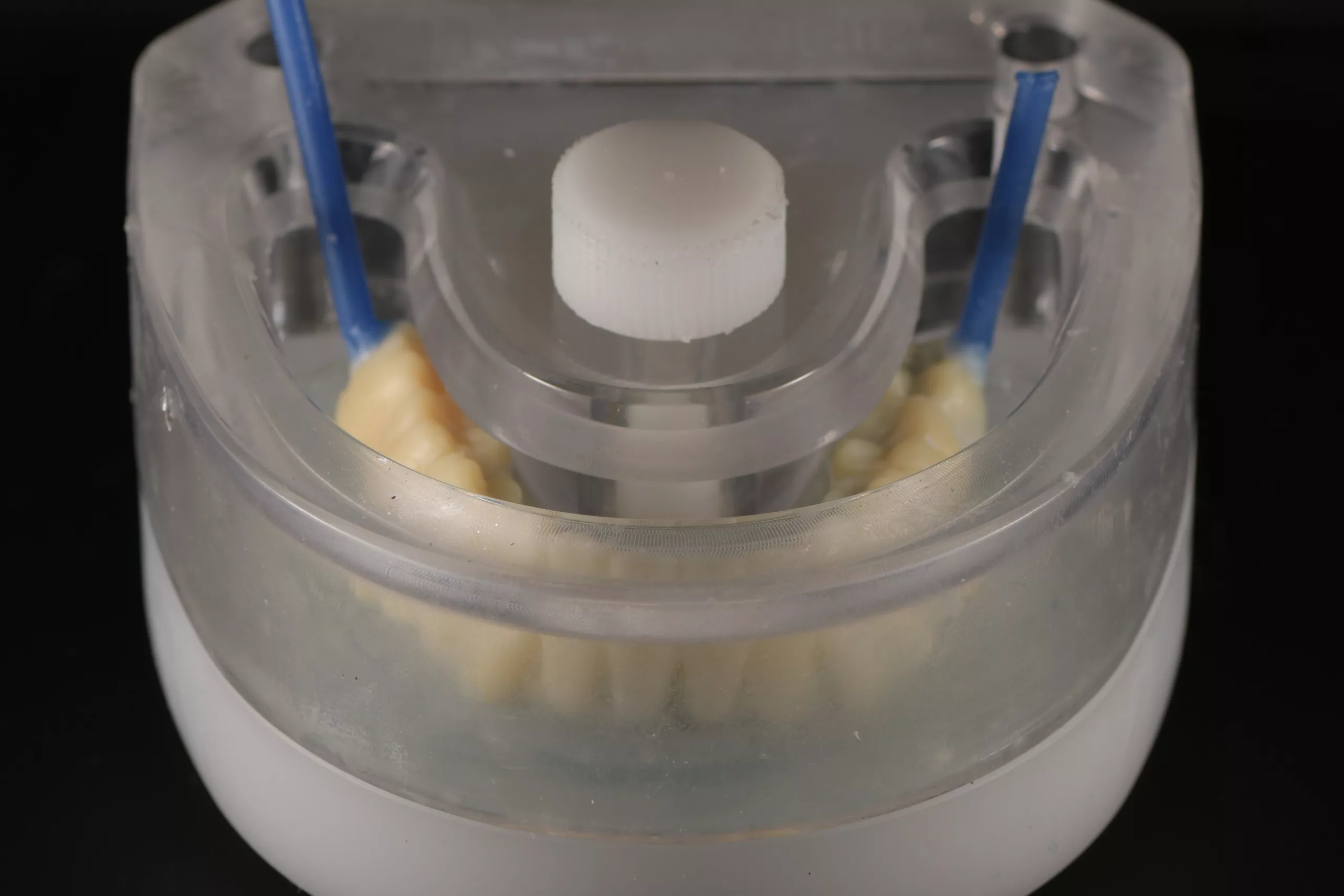Abb. 10: Einbettung des gefrästen Wax-ups.