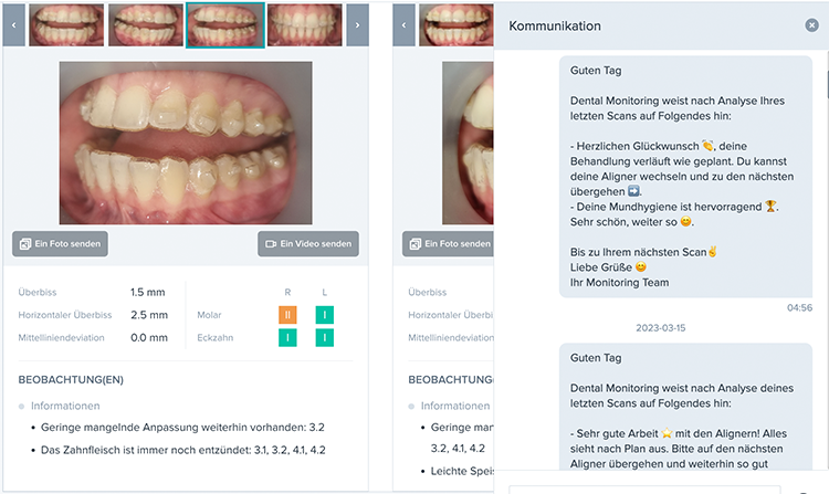 DentalMonitoring überwacht und analysiert jeden Schritt der Behandlung.