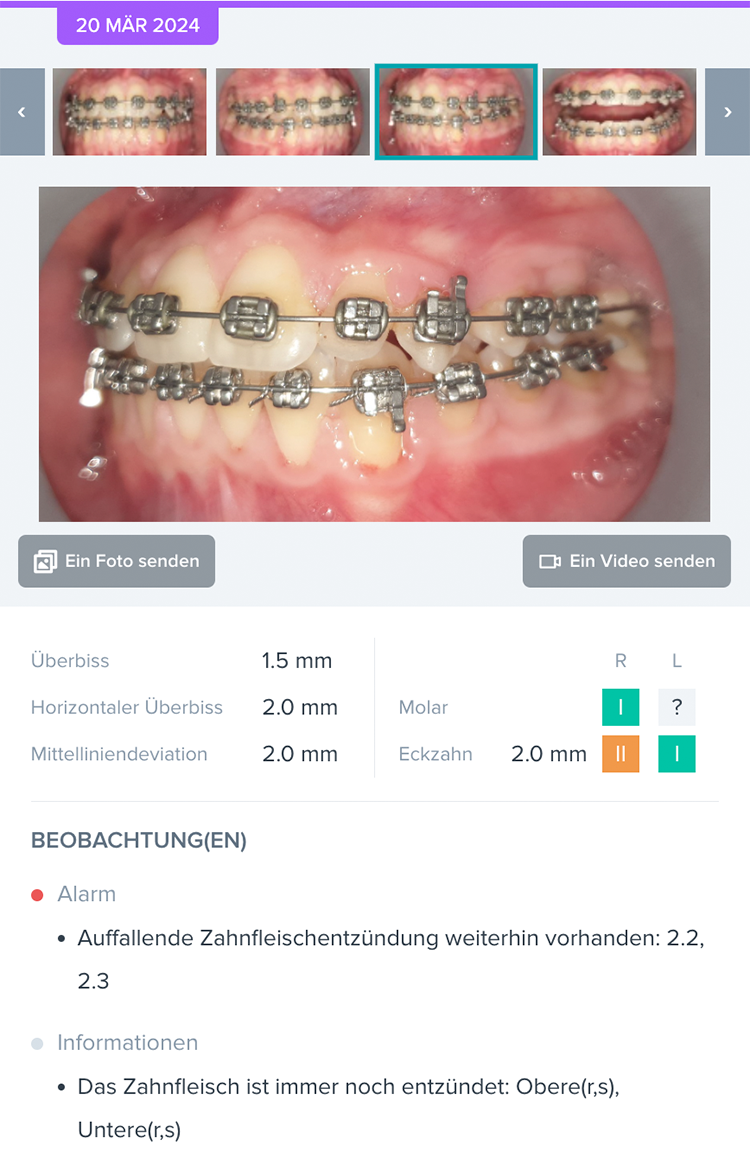 Sämtliche Beobachtungen werden von DentalMonitoring dokumentiert.