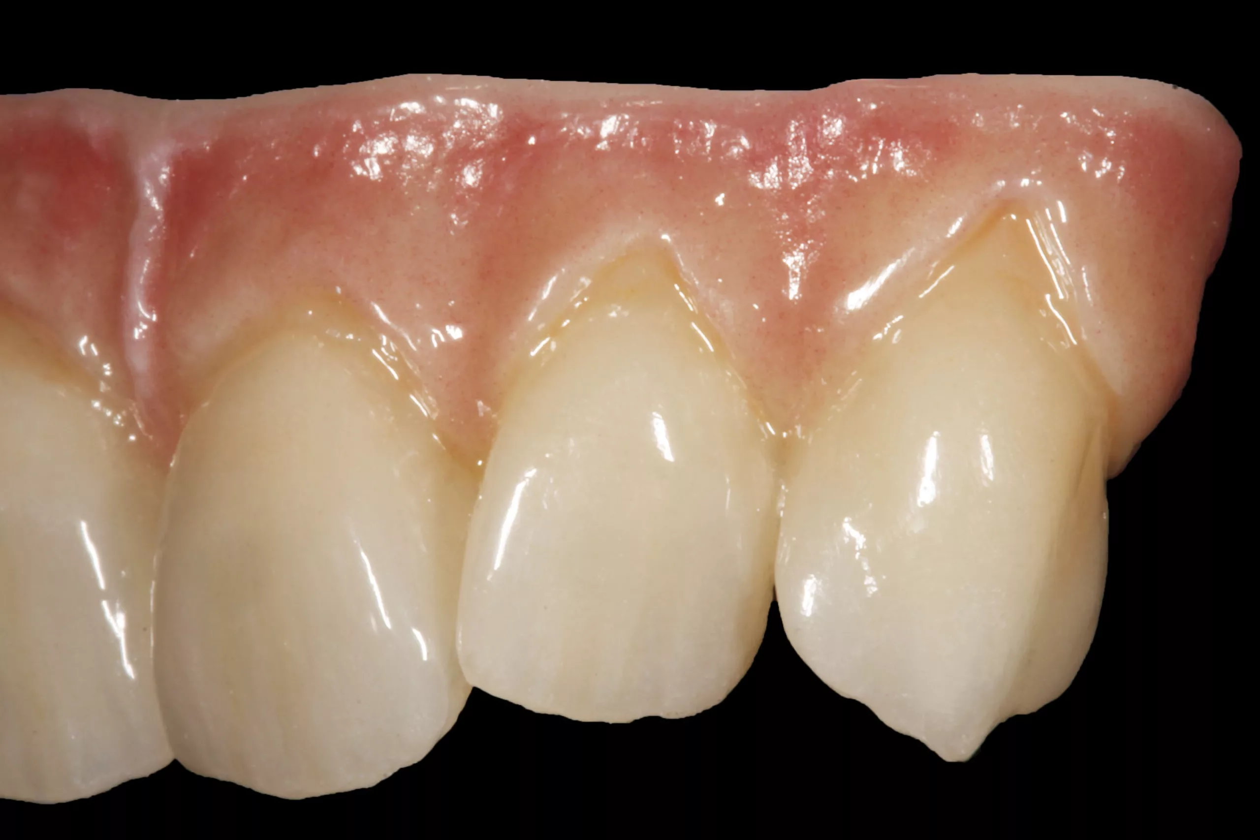 Restauration mit ceraMotion® One Touch von Germano Rossi, Italien.