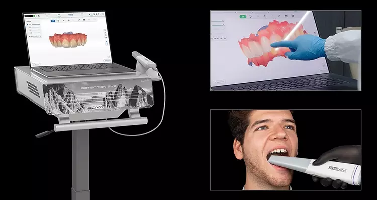 Intraoralscanner Detection Eye