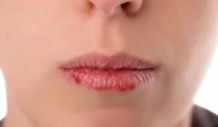 .