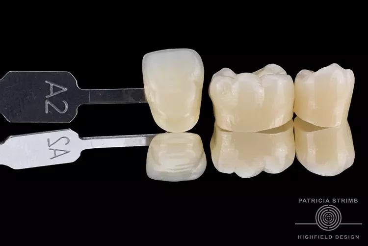Mit der Dokumentation ihrer Wettbewerbsarbeit (monolithische Kronen aus KATANA™ Zirconia STML) kam Patricia Strimb (Zahntechnik Norbert Wichnalek, HIGHFIELD.DESIGN, Augsburg) unter die 10 Finalisten.