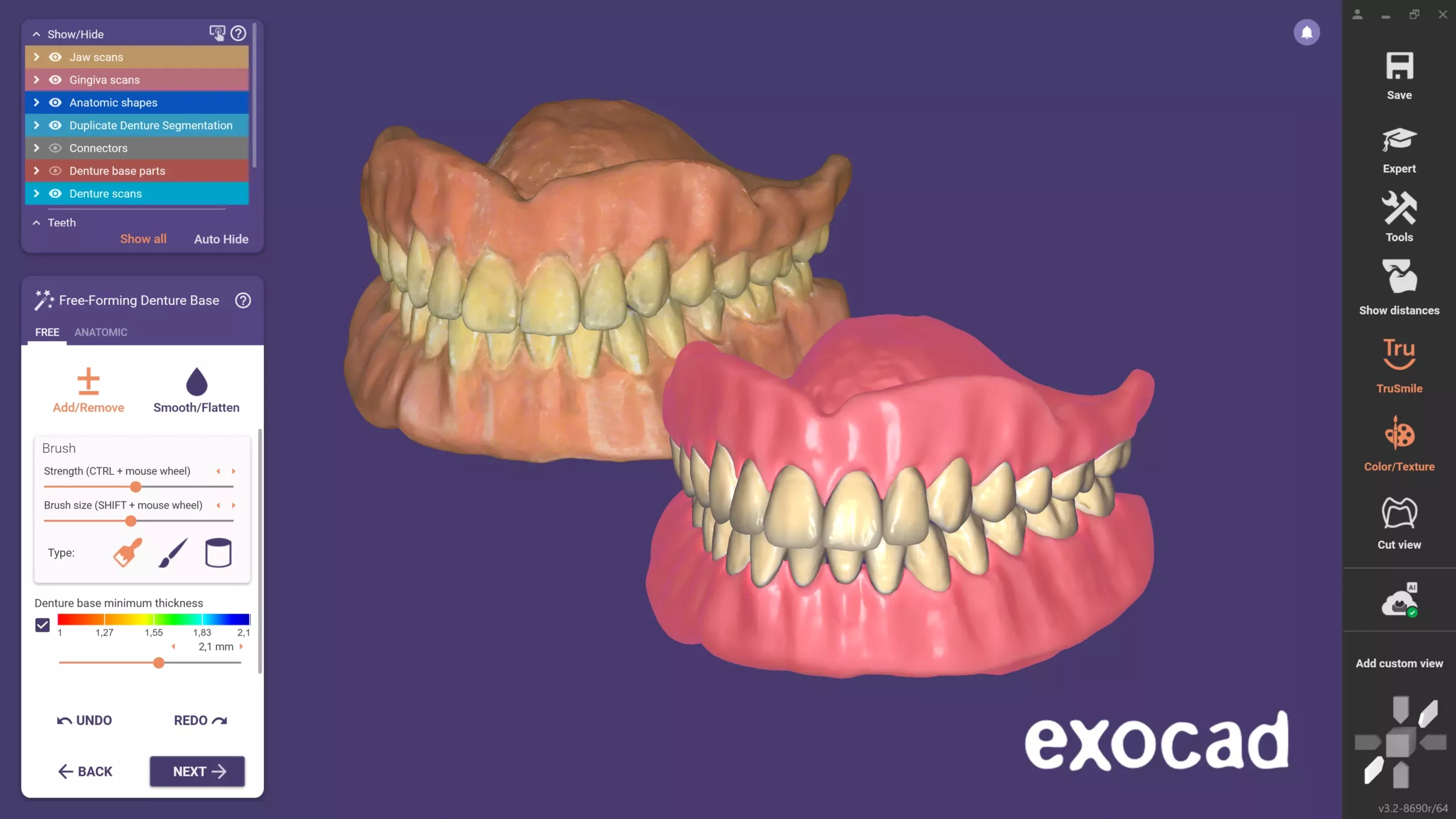 Das Full Denture Modul bietet ein neues Feature für das schnelle Kopieren einer vorhandenen Prothese in einem hochautomatisierten Workflow