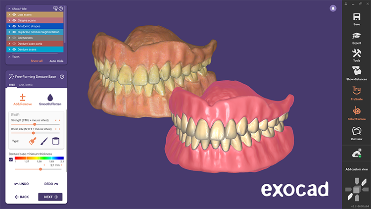 Das Full Denture Modul bietet ein neues Feature für das schnelle Kopieren einer vorhandenen Prothese in einem hochautomatisierten Workflow.