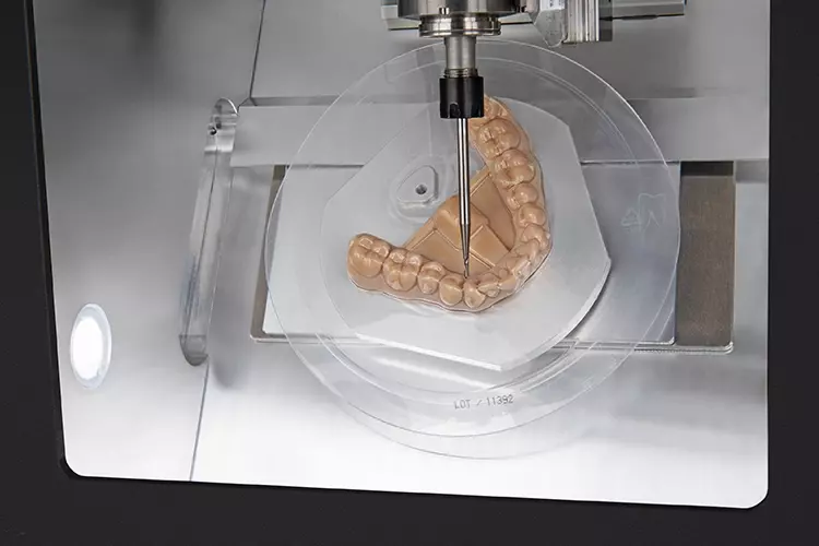 E3 Aligner Trimmen.