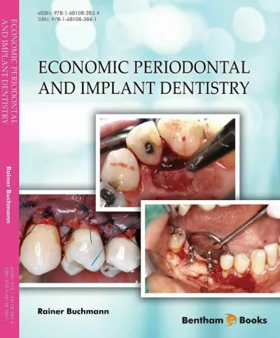 Economic Periodontal and Implant Dentistry