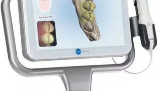 Der iTero-Element-Scanner von Align Technology.