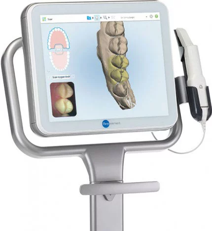 Der iTero-Element-Scanner von Align Technology.