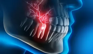 Das intraligamental applizierte Anästhetikum breitet sich entlang der Zahnwurzel und intraossär aus.
